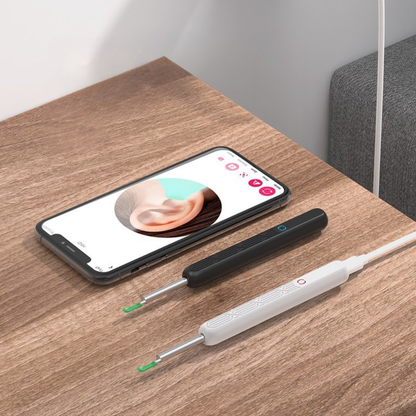 AuricleView™ | Visuele Oorreiniger met HD Camera & App-weergave
